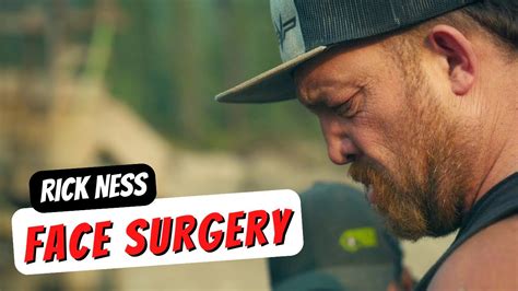 what happened to rick ness face on gold rush|did rick ness get his nose broken.